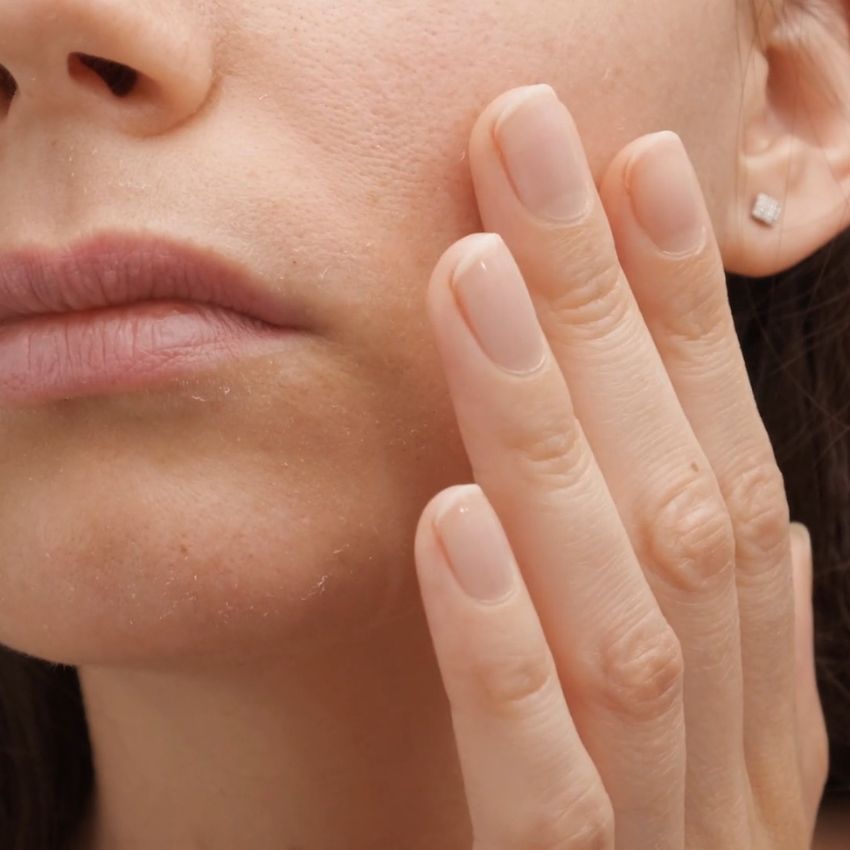 vi peel section image